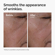 Before and after close-up showing the reduction in the appearance of wrinkles after 8 weeks of using Multi-Peptide + HA Serum.